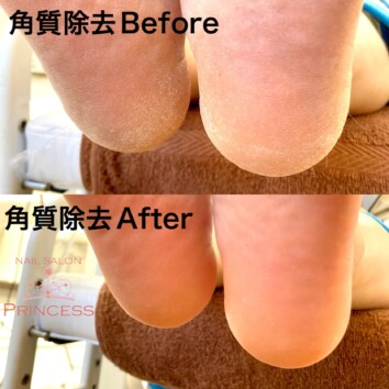 つくばみらい市　フットケア　角質ケア　ネイルサロンプリンセス