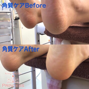 みらい平 フットケア ネイルサロンプリンセス