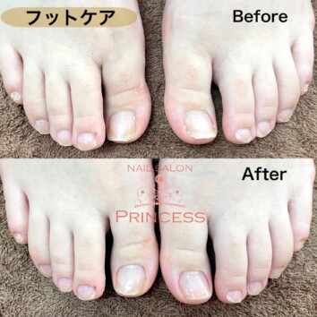 つくばみらい市　フットケア　ネイルサロンプリンセス