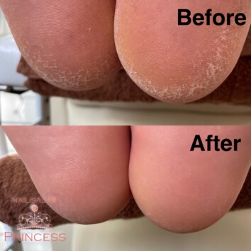 つくばみらい市 角質ケア ネイルサロンプリンセス