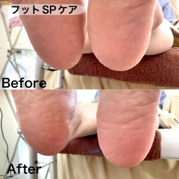 つくばみらい市　フットケア　角質ケア　ネイルサロンプリンセス