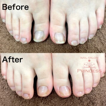 つくばみらい市　フットケア　ネイルサロンプリンセス